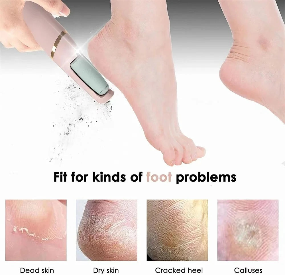 TIMSMILE FOOT GRINDER