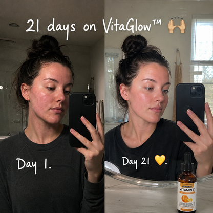 VitaGlow™- Anti-Wrinkle Serum with Vitamin C