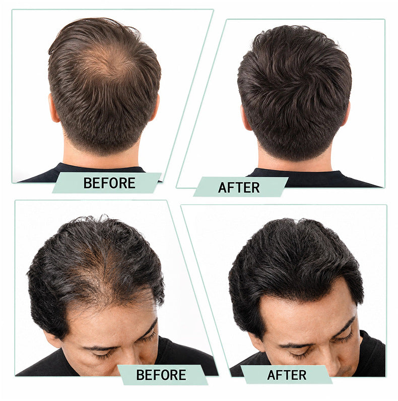 Dr. Elixir™ – Herbal Hair Growth Essential Oil