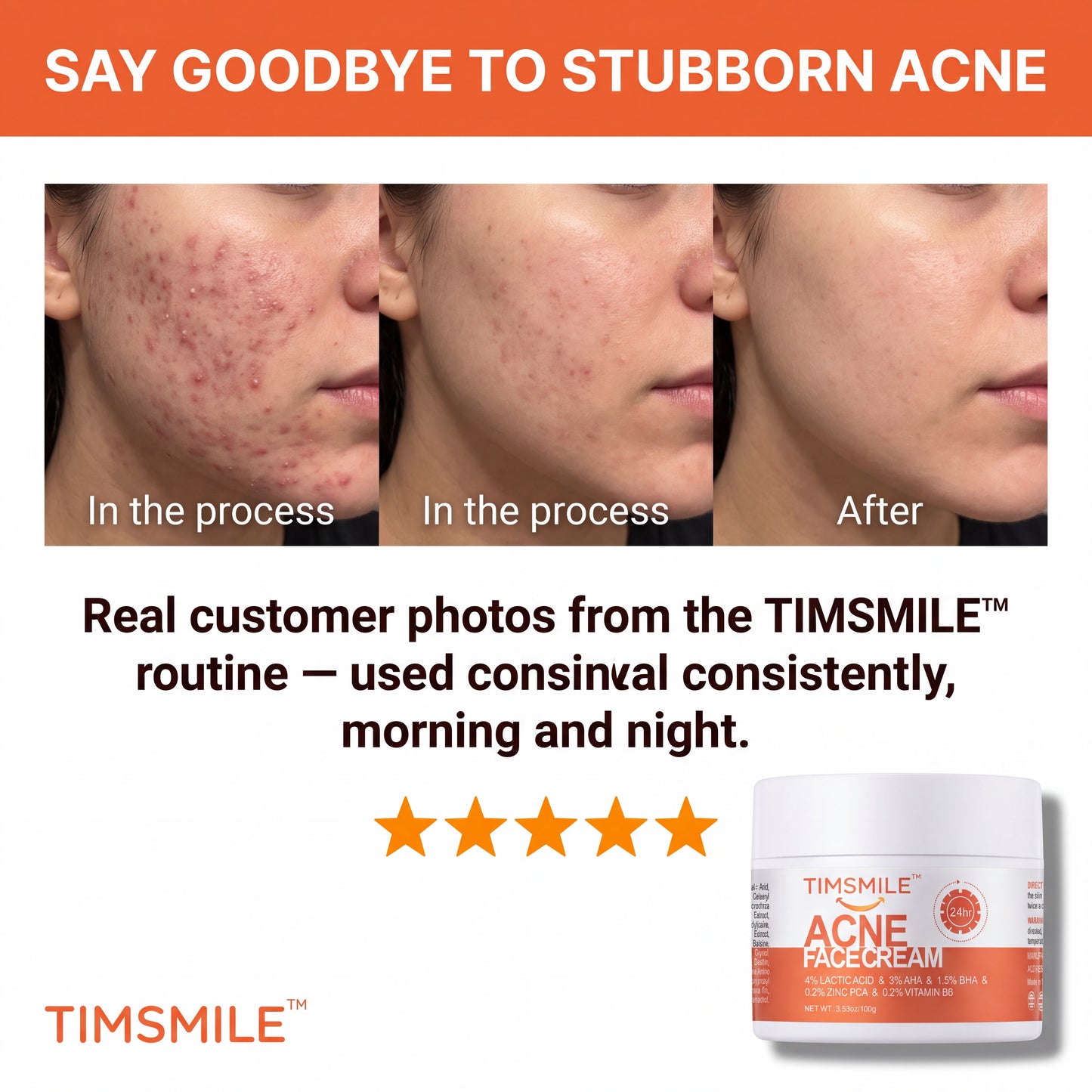 Timsmile™ – Herbal Acne Treatment