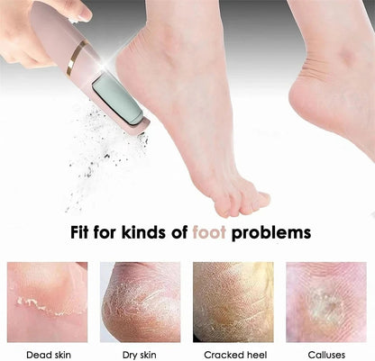TIMSMILE FOOT GRINDER